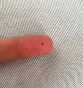 Picture of the tip of my finger with a small black mark on it