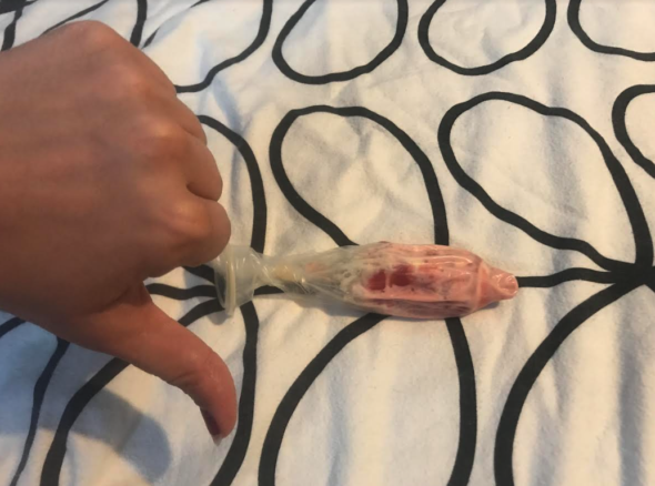 Image of GOTN's hand giving the thumbs-down to a very sad and manky-looking condom full of yellow-ice-cream and red crushed ice that was once an ice lolly